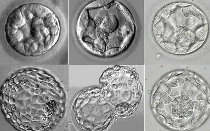 西安供卵机构包成功费用-解冻4bb到5bb囊胚时的成功率详情。